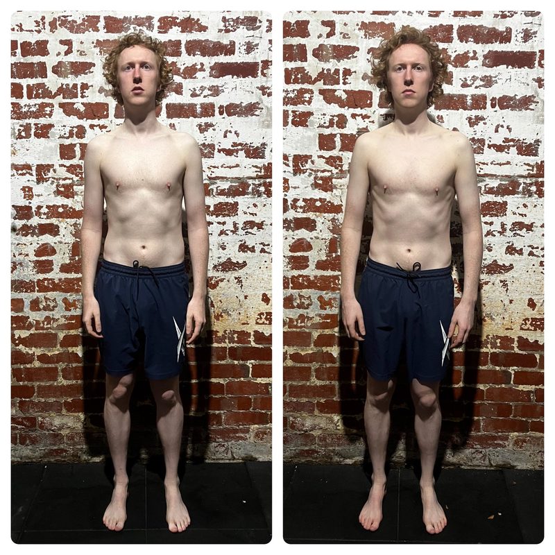 Charlie posture before and after Functional Patterns training