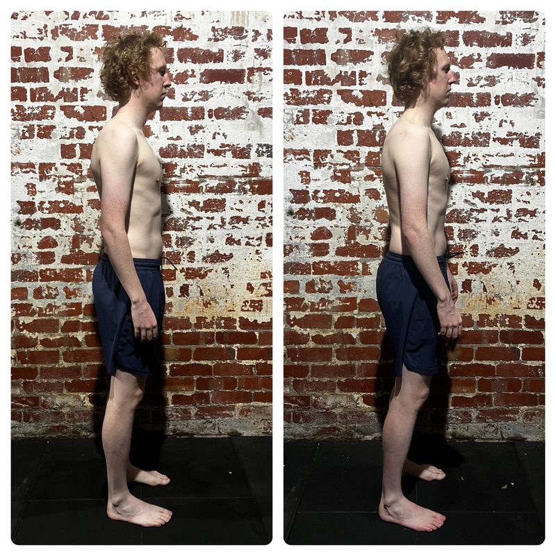 Charlie posture before and after Functional Patterns training